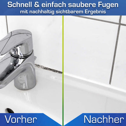 AGO Schimmelentferner Set - Starter 9 Teile
