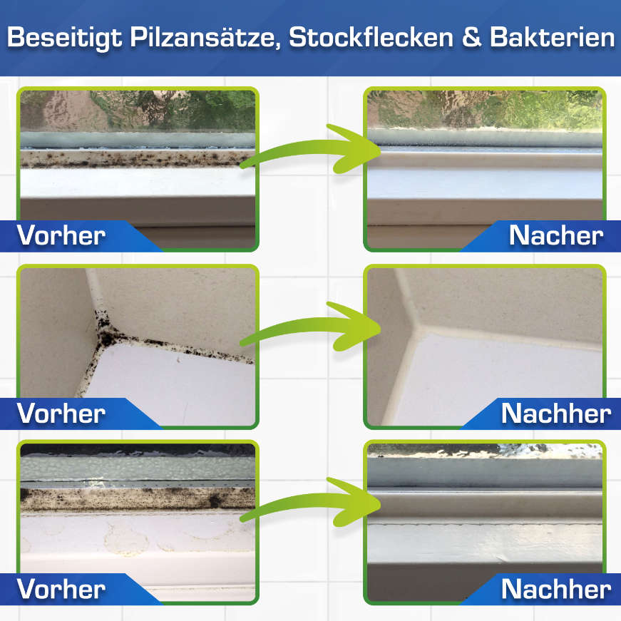 AGO Schimmelentferner Set - Starter 9 Teile