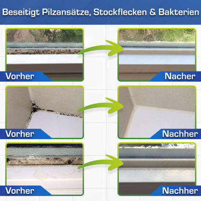 AGO Schimmelentferner Set - Starter 9 Teile